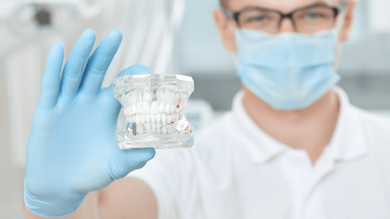 Имплантация — оптимальная методика восстановления зубов