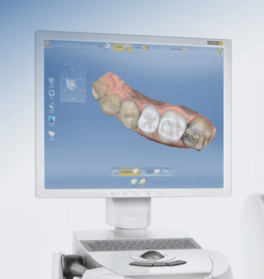 Cоздается цифровая модель будущих зубов